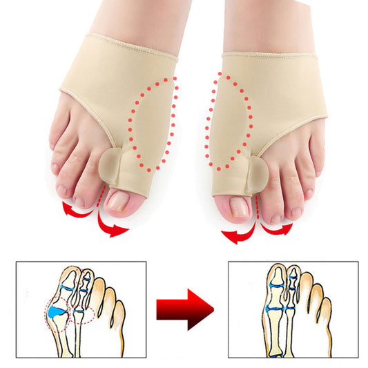 VIP Only Offer - Hyggear Big Toe Bunion Corrector
