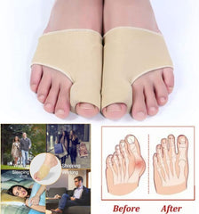 HYGGEAR Big Toe Bunion Corrector