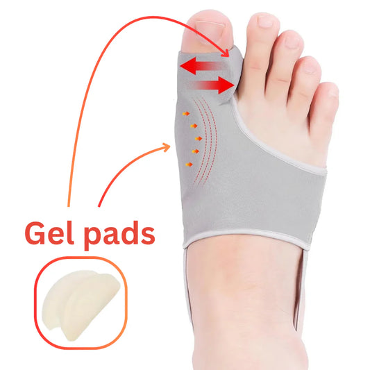 Hyggear Big Toe Bunion [Hallux Valgus] Corrector